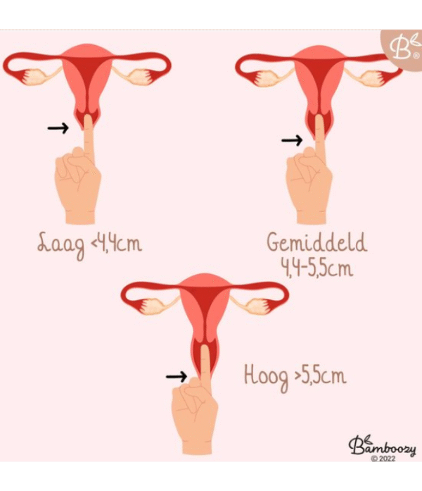 Duurzaam360 - Bamboozy Menstruatiedisc - Herbruikbare Menstruatie Disc - Menstruatiedisk - Disk - Period - Menstrueren - Zero Waste - duurzaam leven - Bamboozy - lekvrij